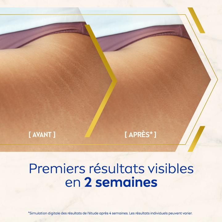 Actual product image NIVEA Luminous Body Öl-Serum Anti-Dehnungsstreifen (Body oil, 100 ml)