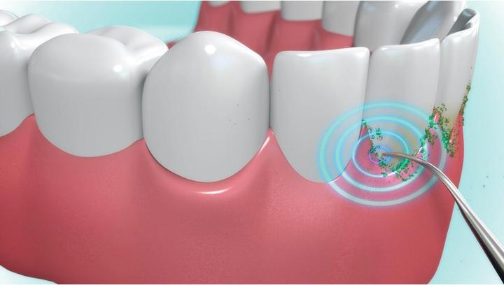 Actual product image MediaShop Tooth cleaning system (Toothbrush steriliser)