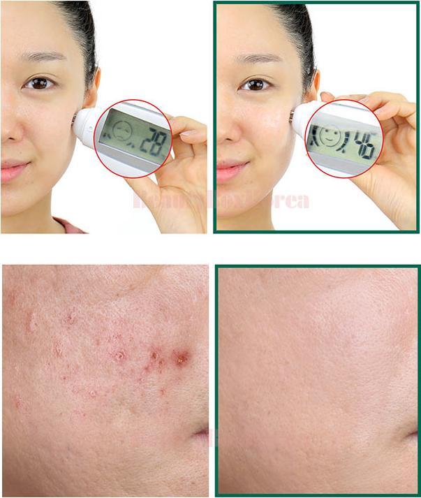 Immagine prodotto Some By Mi 30 Days Miracle (Lozione detergente)