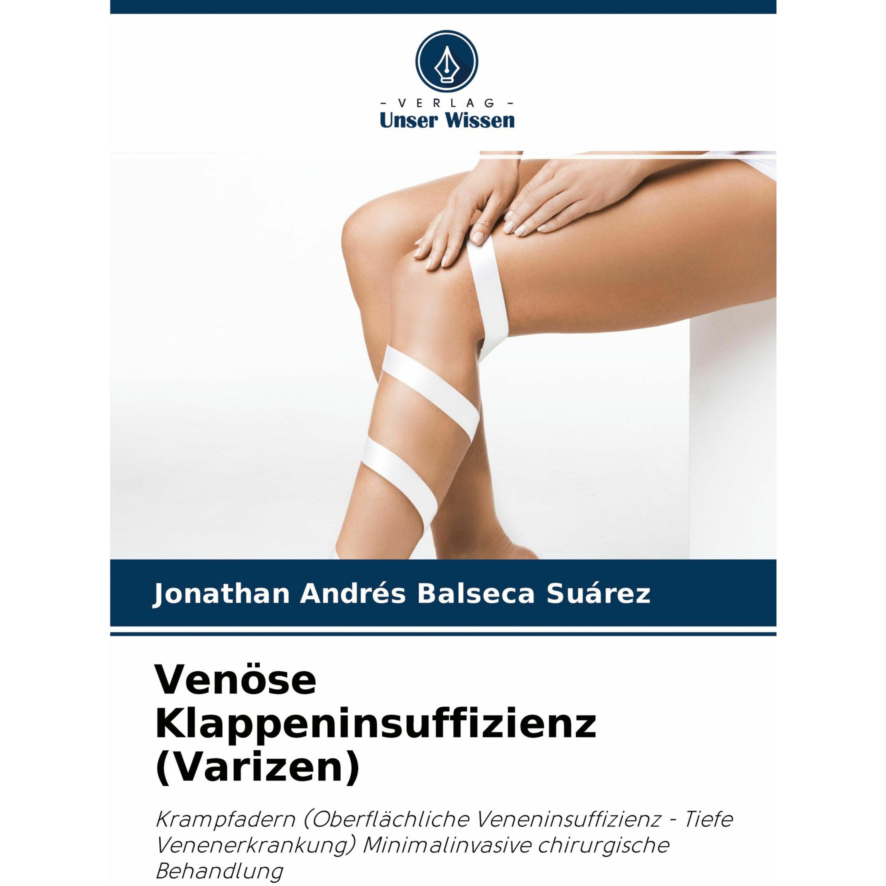 Balseca Suárez:Venöse Klappeninsuffizie, Fachbücher von Jonathan Andrés Balseca Suárez