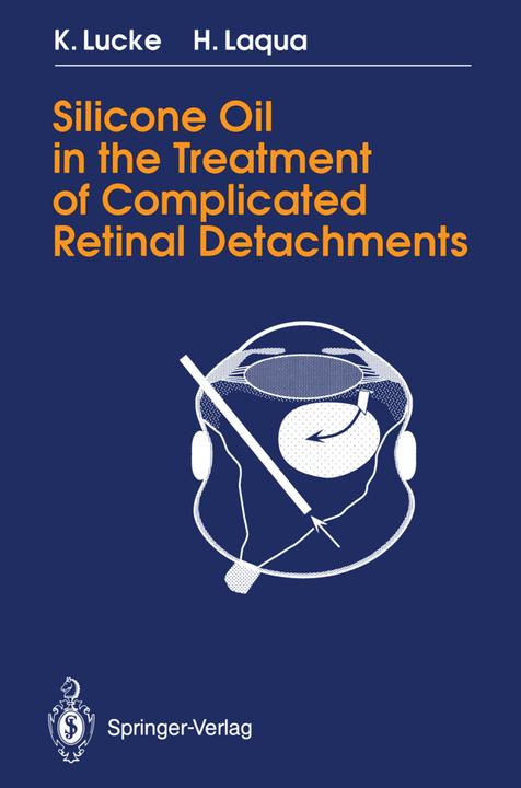Produktbild Silicone Oil in the Treatment of Complicated Retinal Detachments (Englisch, Horst Laqua, Klaus Lucke, 2012)