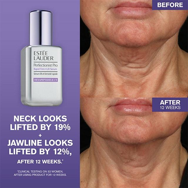 Actual product image Estée Lauder Perfectionist Pro (50 ml)
