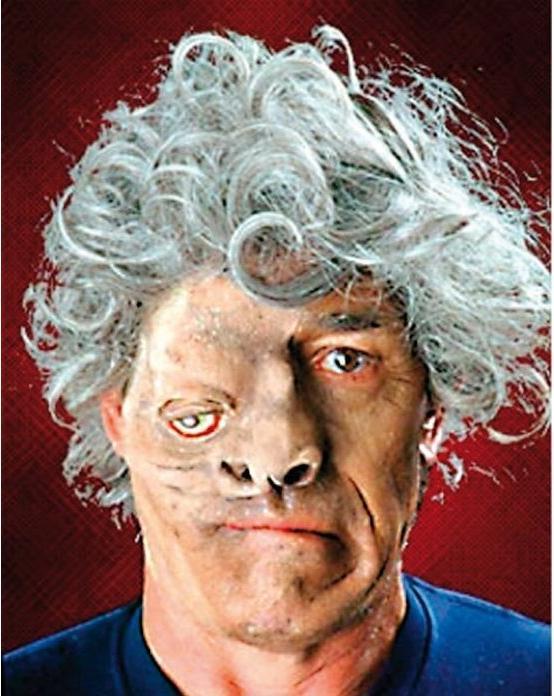 Image du produit Eulenspiegel Prothèse Quasimodo