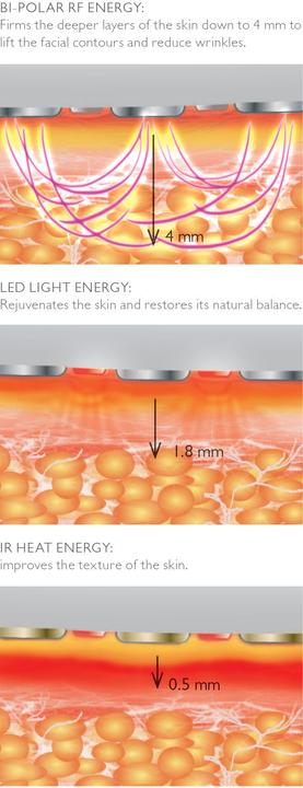 Actual product image Silk'n Antiaging device FaceTite Essential Cordless