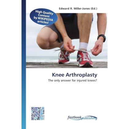 Knee Arthroplasty, Fachbücher von Edward R. Miller-Jones