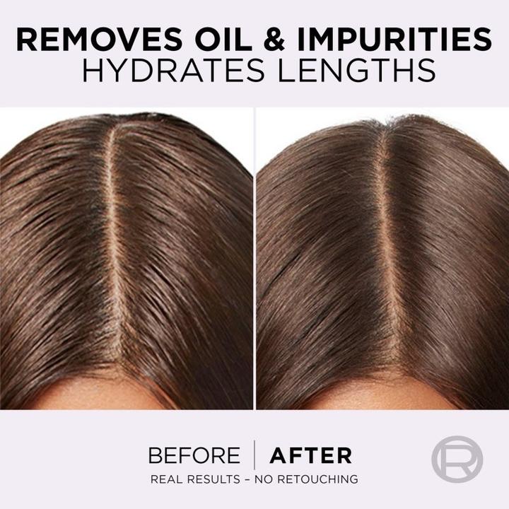 Actual product image L'Oréal Paris Elseve Hyaluron Pure Oil Erasing Scalp Serum (102 ml)