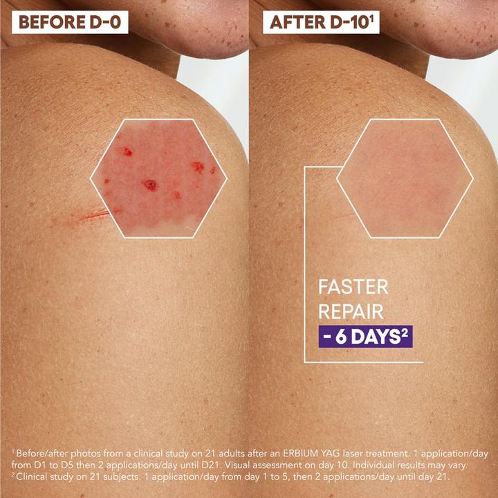 Immagine prodotto A-Derma EPITELIALE A.H Ultra Crema (Crema corpo, 40 ml)