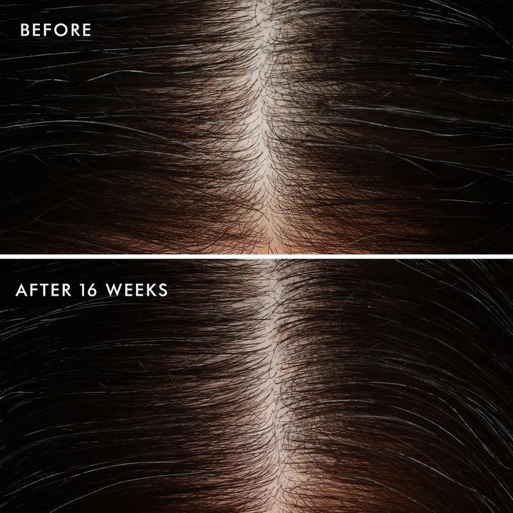 Produktbild Moroccanoil Scalp Balancing Conditioner (250 ml)