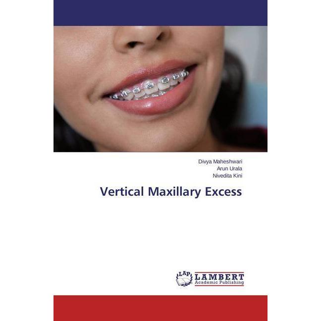 Vertical Maxillary Excess, Fachbücher von Nivedita Kini, Arun Urala, Divya Maheshwari