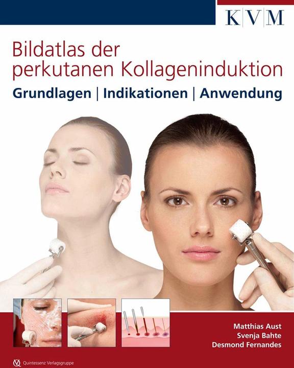 Produktbild Bildatlas der perkutanen Kollageninduktion (Deutsch, Desmond Fernandez, Matthias Aust, Svenja Bahte, 2013)