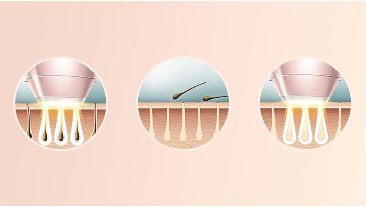 Immagine prodotto Philips Lumea Prestige