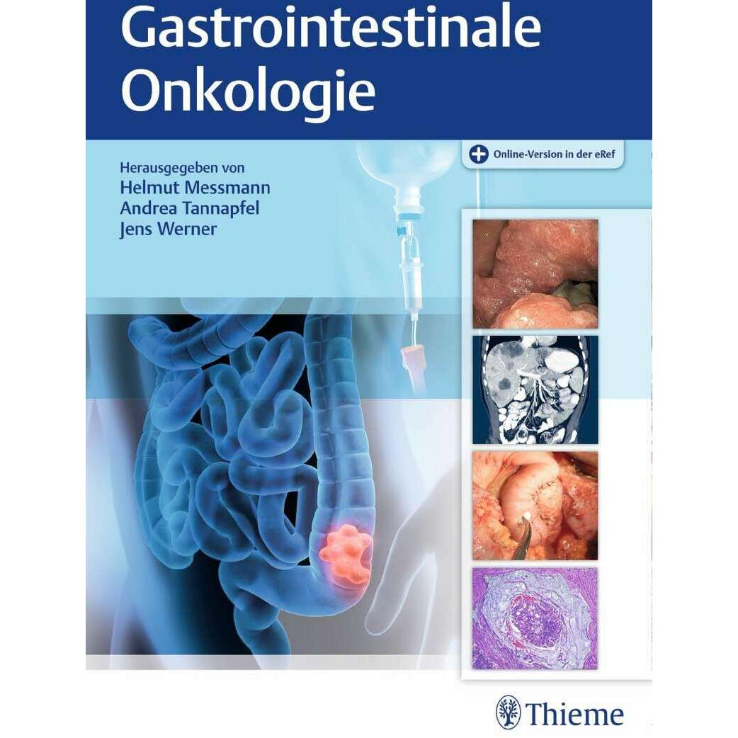 Gastrointestinale Onkologie, Fachbücher von Helmut Messmann, Jens Werner, Andrea Tannapfel