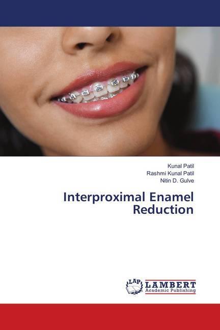 Actual product image Interproximal Enamel Reduction (German, Rashmi Kunal Patil, Kunal Patil, Nitin D. Gulve, 2018)