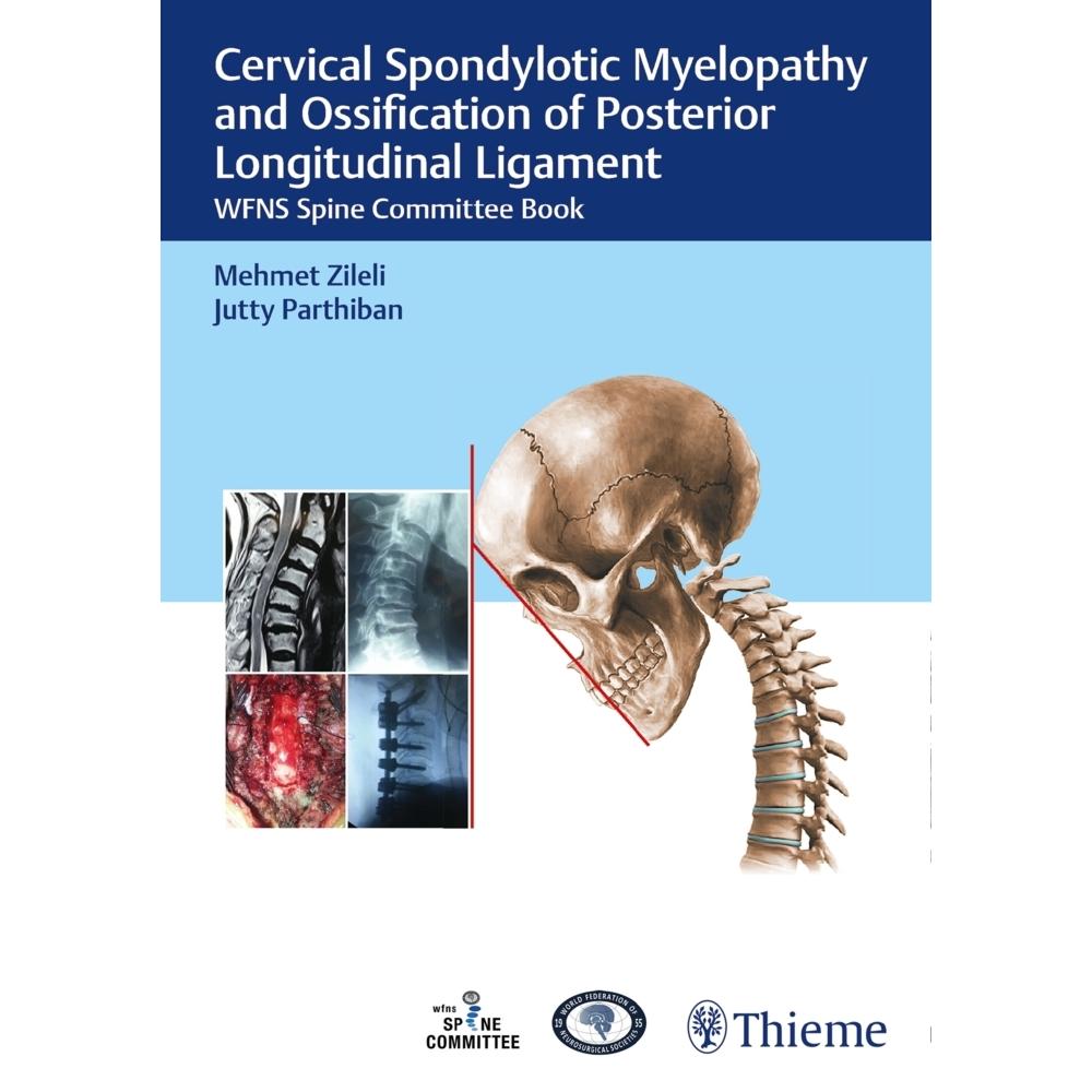 Cervical Spondylotic Myelopathy and Oss, Ratgeber von Mehmet Zileli, J.K.B.C. Parthiban