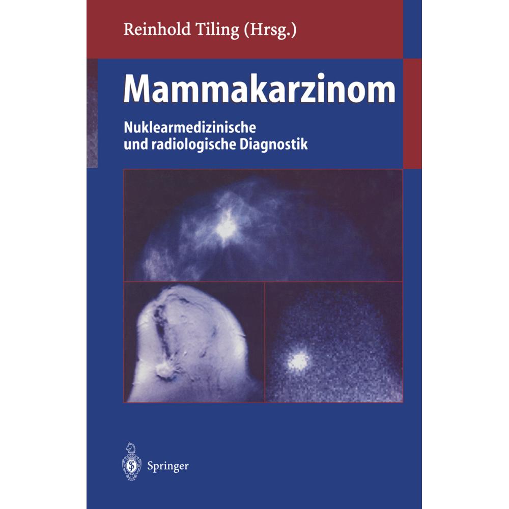 Mammakarzinom, Fachbücher von Reinhold Tiling