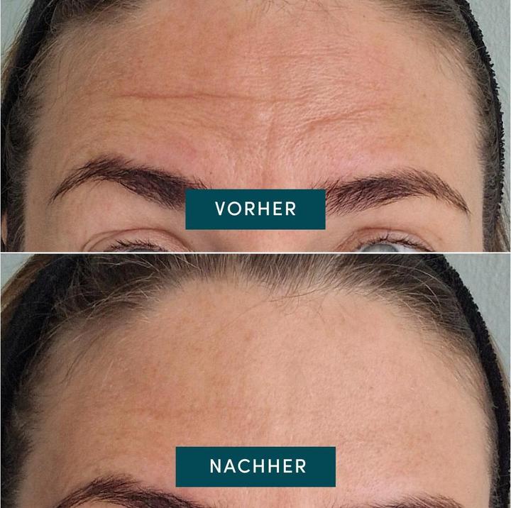 Immagine prodotto Apricot Glow booster