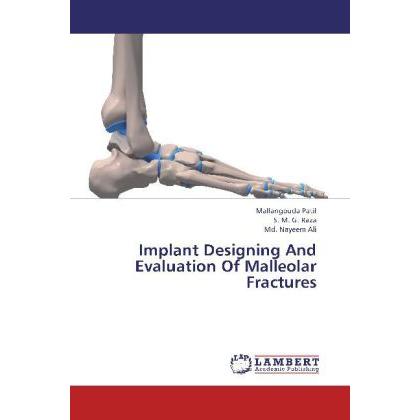 Implant Designing And Evaluation Of Malleolar Fractures, Fachbücher