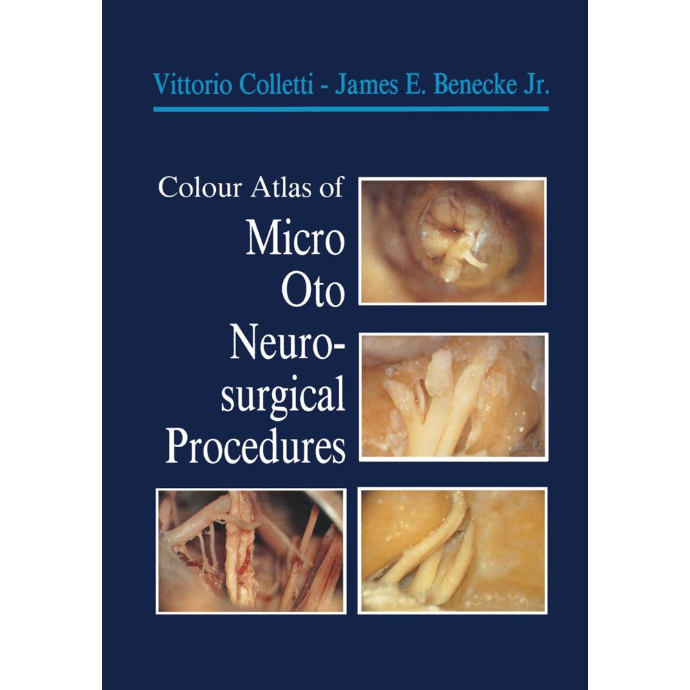 Colour Atlas of Micro-Oto-Neurosurgical Procedures, Fachbücher von James E. Benecke, Vittorio Colletti