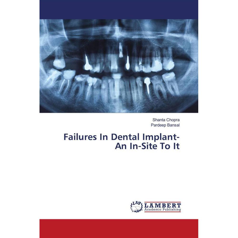 Failures In Dental Implant- An In-Site To It, Fachbücher von Shanta Chopra, Pardeep Bansal