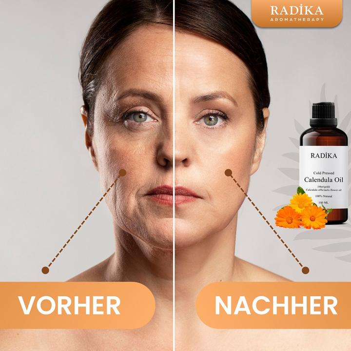 Produktbild Radika Calendula-Öl, Kaltgepresst, 100% Rein, BIO, natürlich, 30 ml (Körperöl, 30 ml)