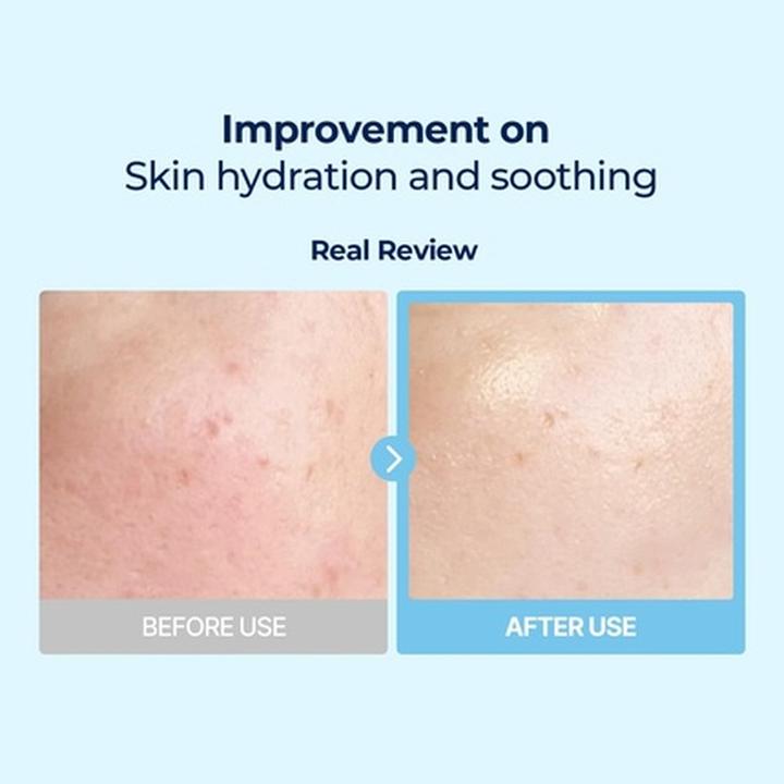 Actual product image Torriden Low Molecule Hyaluronic Acid Multi Pads (160 ml)