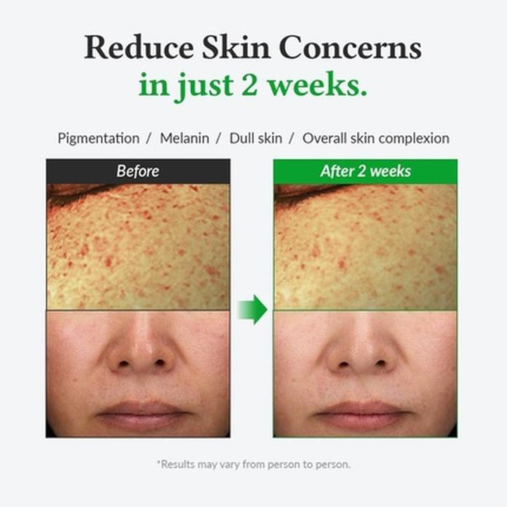 Actual product image Dr. Althea Gentle Vitamin C (30 ml)