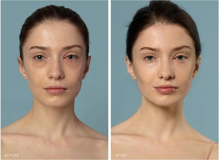 Actual product image Foreo Ufo 3