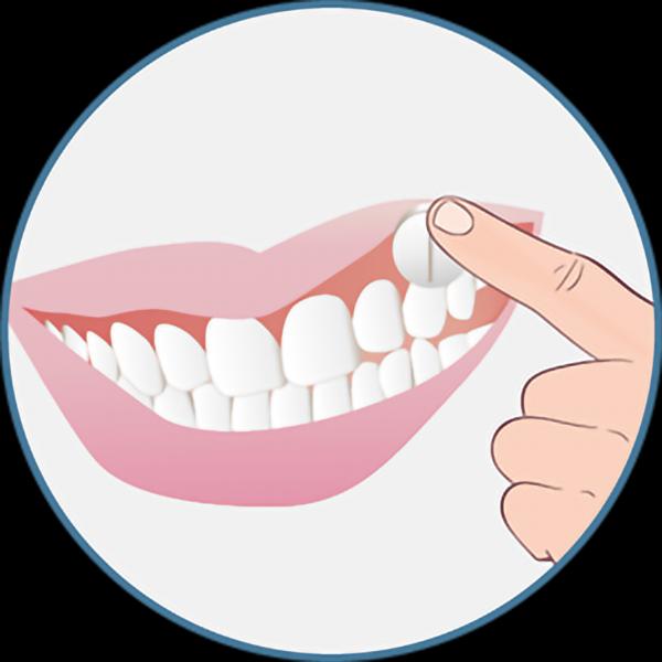 Immagine prodotto Xylimelts Compresse adesive contro la secchezza delle fauci (40 x, 270 ml, 59 g)