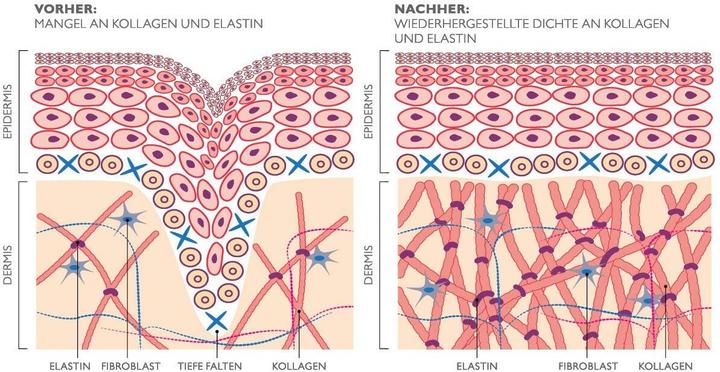 Produktbild Silk'n FTC1PE1001