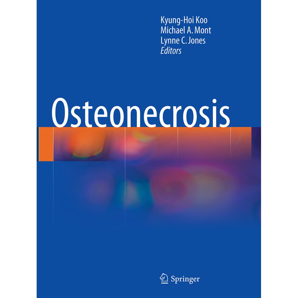 Osteonecrosis, Fachbücher von Michael A. Mont, Kyung-Hoi Koo, Lynne C. Jones
