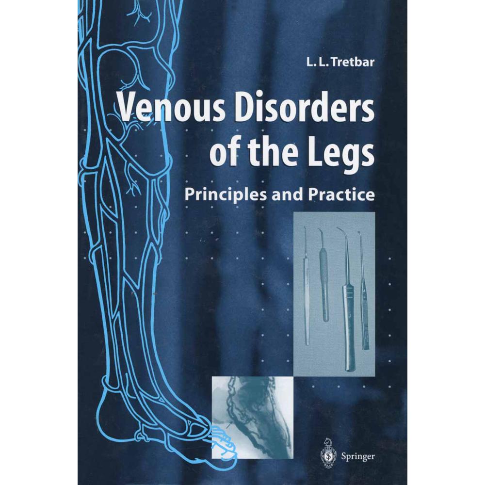 Venous Disorders of the Legs, Fachbücher von Lawrence L Tretbar