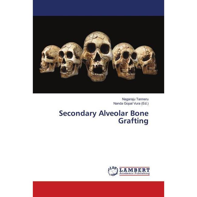 Secondary Alveolar Bone Grafting, Fachbücher von Nagaraju Tanneru