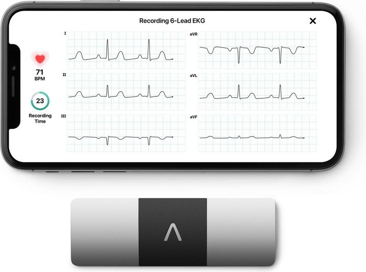 Produktbild AliveCor EKG-Gerät Al Kardiamobile 6l