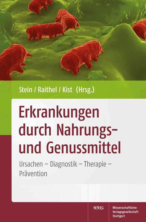 Produktbild Erkrankungen durch Nahrungs- und Genussmittel (Deutsch, Jürgen Stein, Manfred Kist, Martin Raithel, 2011)