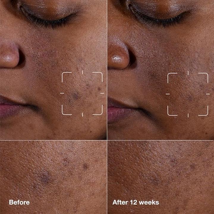 Actual product image Clinique Even Better Clinical Dark Spot Clearing Serum (30 ml)