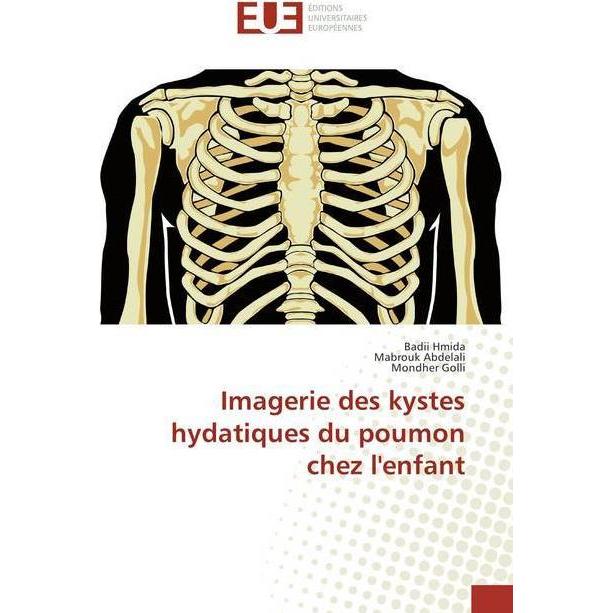 Imagerie des kystes hydatiques du poumon chez l'enfant, Fachbücher von Badii Hmida, Mondher Golli, Mabrouk Abdelali