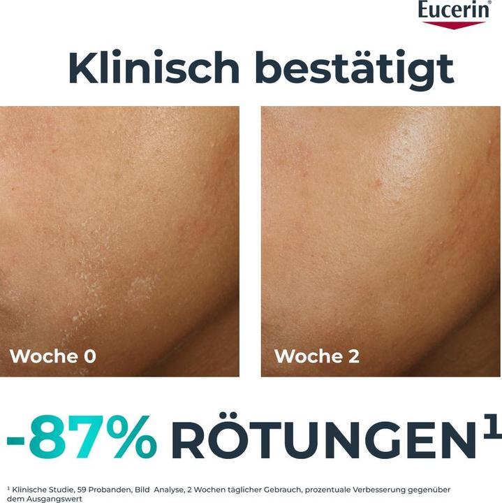 Image du produit Eucerin Soins hydratants accompagnant la thérapie (40 ml, Crème de jour)