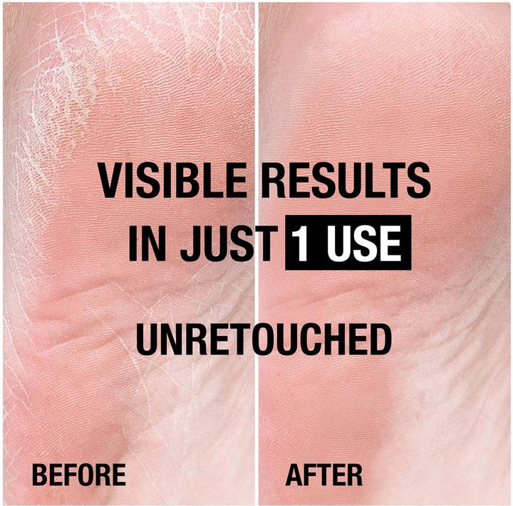 Produktbild Neutrogena Reichhaltige Fusscreme (Fusscrème & Fussgel, 100 ml)