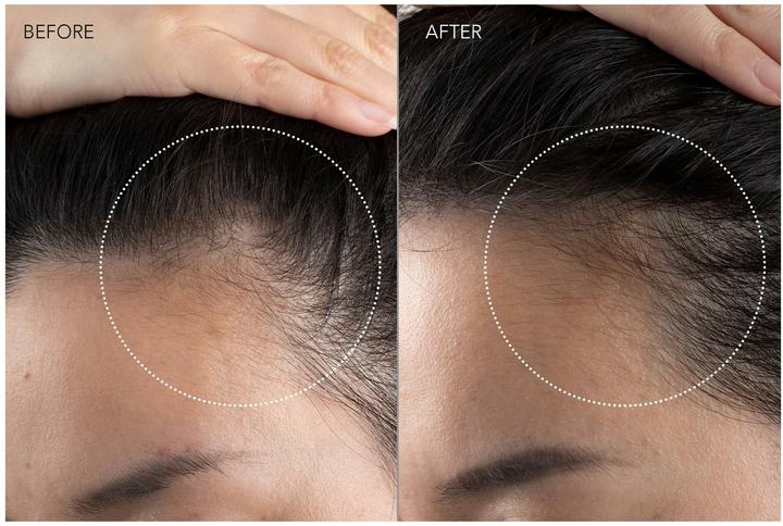 Produktbild Foreo FAQ 301 (Haircare Device, 1 unit)