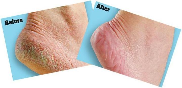 Image du produit O'Keeffe's Crème pour les pieds Healthy Feet (Déodorants & poudre pour les pieds)