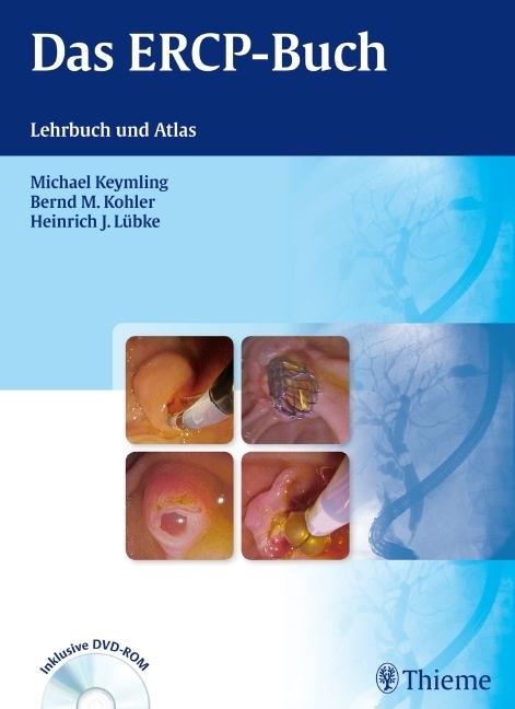 Produktbild Das ERCP-Buch (Deutsch, Bernd M. Kohler, Heinrich J. Lübke, Michael Keymling, 2012)