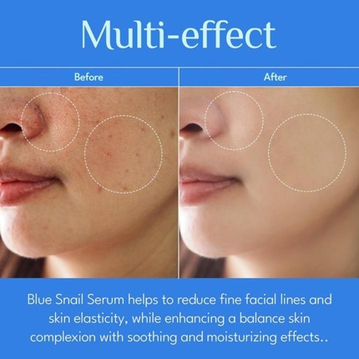 Actual product image Skin Gin IT'S SKIN Blue Snail Serum Day and Night Serum for Face with Snail Mucin Essence and Centella Asiati (40 ml)