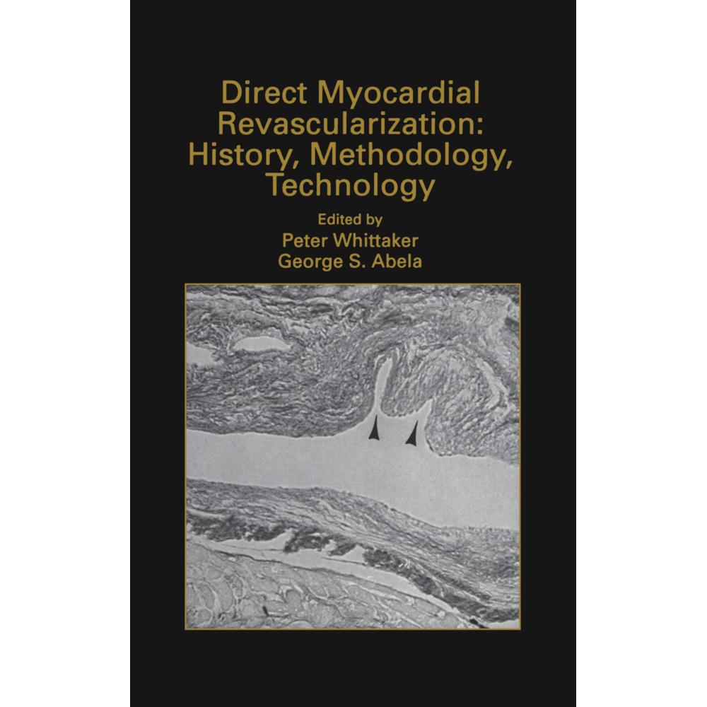 Direct Myocardial Revascularization: History, Methodology, Technology, Fachbücher