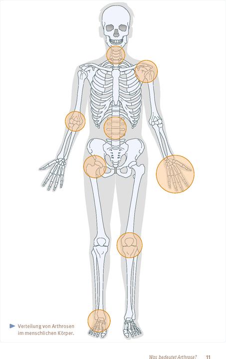 Image du produit Expertenwissen: Arthrose (Allemand, Prof. Dr Hanno Steckel, 2024)