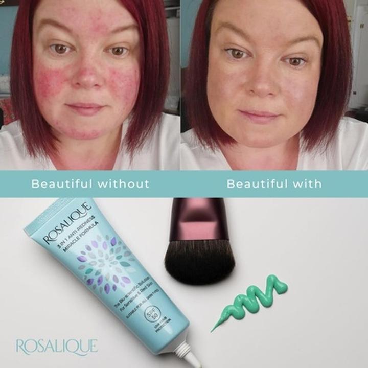 Produktbild Rosalique 3 in 1 Anti-Redness Miracle Formula (30 ml)
