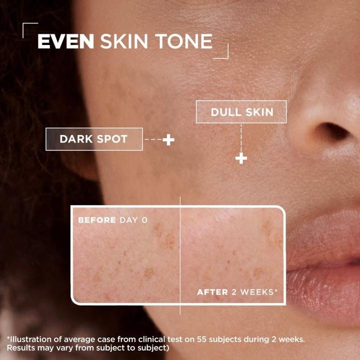 Produktbild Mixa Anti-Dark Spot (30 ml)