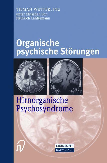 Produktbild Organische psychische Störungen (Deutsch, Tilman Wetterling, 2012)