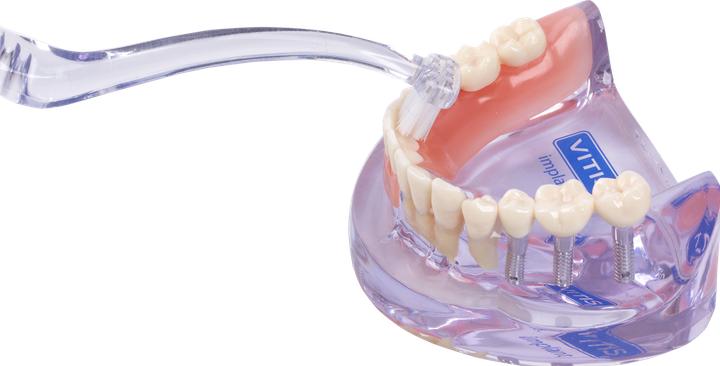 Productafbeelding Dentaid Vitis Implantaat Hoekig (1 x)