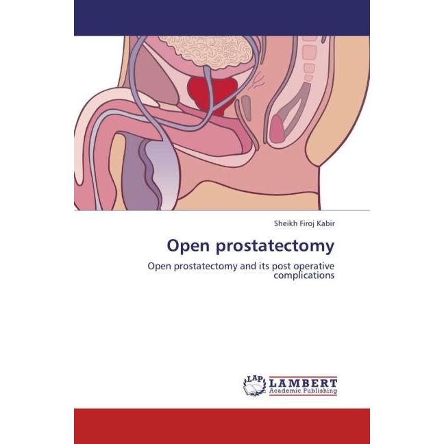 Thumbnail - Open prostatectomy, Fachbücher