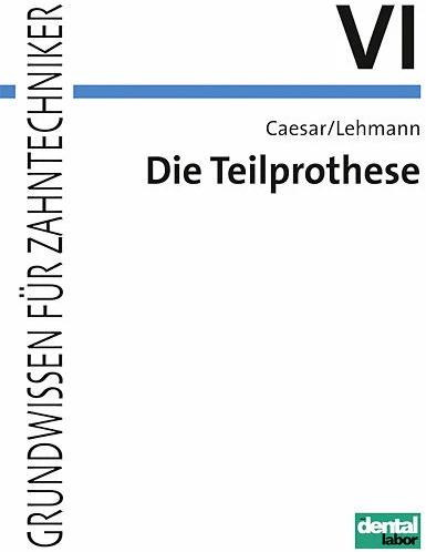 Produktbild Die Teilprothese (Deutsch, H Hans Caesar, Hans H. Caesar, Klaus M. Lehmann, 2007)